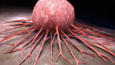 خلايا السرطان