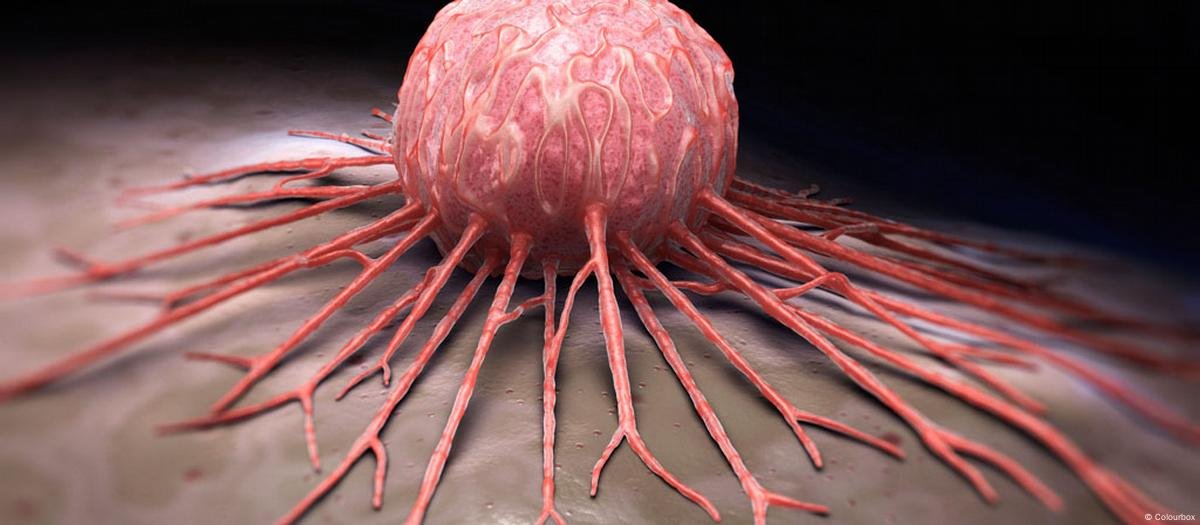 خلايا السرطان