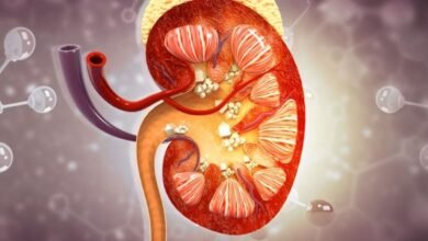 باحثون يطورون علاجاً جذرياً لحصوات الكلى باستخدام بكتيريا الأمعاء