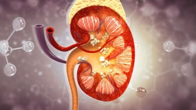 باحثون أمريكيون يبتكرون علاجا جذريا لحصوات الكلى