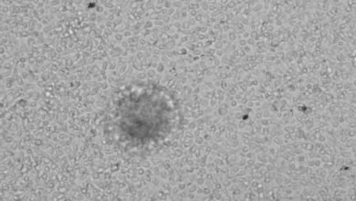 مركز أبوظبي للخلايا الجذعية يطلق علاجاً مبتكراً للسرطان، يفتح آفاق أمل جديدة للمرضى في المنطقة