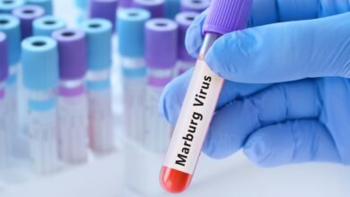 إثيوبيا تعلن تفشي وباء "ماربورغ" جنوب البلاد