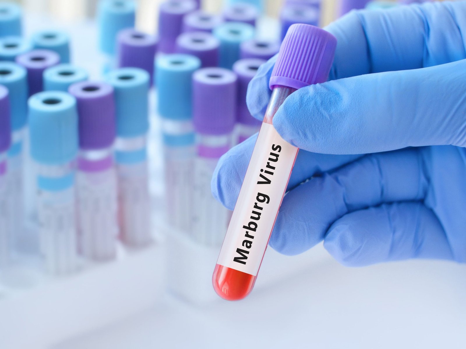 إثيوبيا تعلن تفشي وباء "ماربورغ" جنوب البلاد 1 إثيوبيا تعلن تفشي وباء "ماربورغ" جنوب البلاد