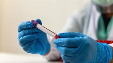 علماء روس يبتكرون تقنية تعزز فعالية علاج سرطان الدم ثمانية أضعاف