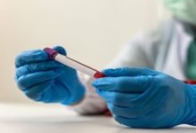 "فيرتيسيلين أ".. علماء ينجحون في تصنيع مركب فطري واعد ضد السرطان