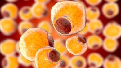 فقدان الوزن