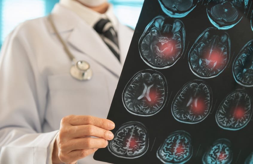 جهاز مبتكر يعيد النطق لمرضى السكتة الدماغية 1 جهاز مبتكر