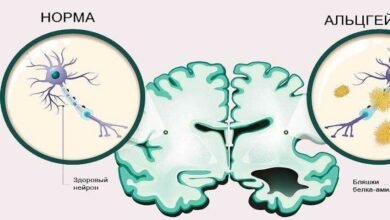 تراكم البروتينات