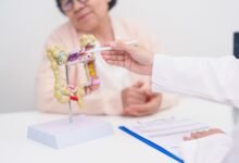 علماء كوريون يكتشفون طريقة واعدة لإبطاء سرطان القولون وزيادة فرص النجاة