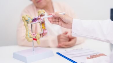 علماء كوريون يكتشفون طريقة واعدة لإبطاء سرطان القولون وزيادة فرص النجاة 2 علماء كوريون يكتشفون طريقة واعدة لإبطاء سرطان القولون وزيادة فرص النجاة