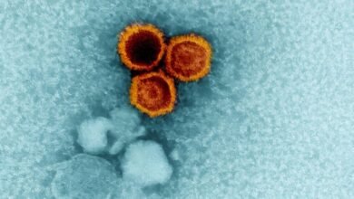 التصلب العصبي المتعدد