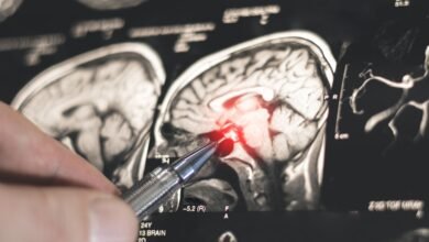 اكتشاف روسي جديد يفتح الطريق لتطوير أدوية لعلاج باركنسون