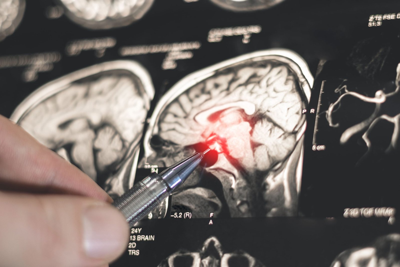 اكتشاف روسي جديد يفتح الطريق لتطوير أدوية لعلاج باركنسون 1 اكتشاف روسي جديد يفتح الطريق لتطوير أدوية لعلاج باركنسون