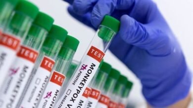 الكونغو الديموقراطية تعلن انتهاء تفشي مرض جدري القرود