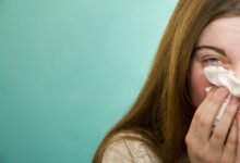 الإنفلونزا