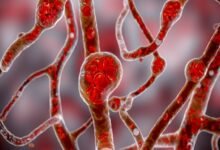 الكركم الذهبي