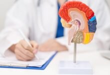 السكتة الدماغية