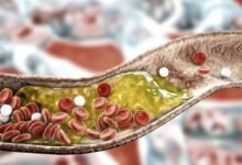 سرّ بسيط لصحة القلب.. أطعمة تخفض الكوليسترول خلال أسابيع