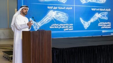 "الفارس الشهم 3" و"الأعمال الخيرية العالمية" تطلقان برنامج "خطوة أمل" لتصنيع وتركيب الأطراف الصناعية انطلاقاً من العريش 3 الفارس الشهم 3